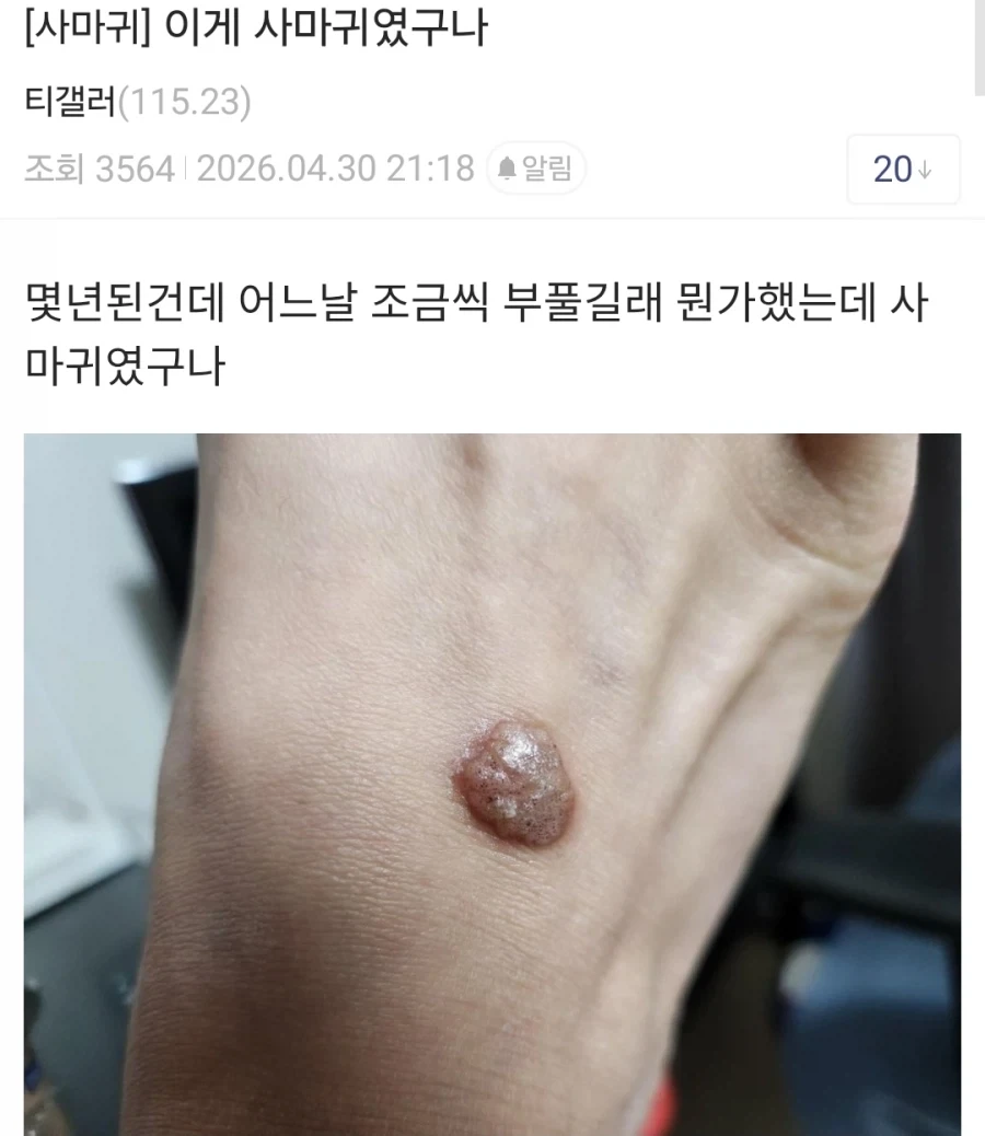 티눈갤보는데 ㅅㅂ 존나웃기네ㅋㅋㄱㄱㅋ_1.webp