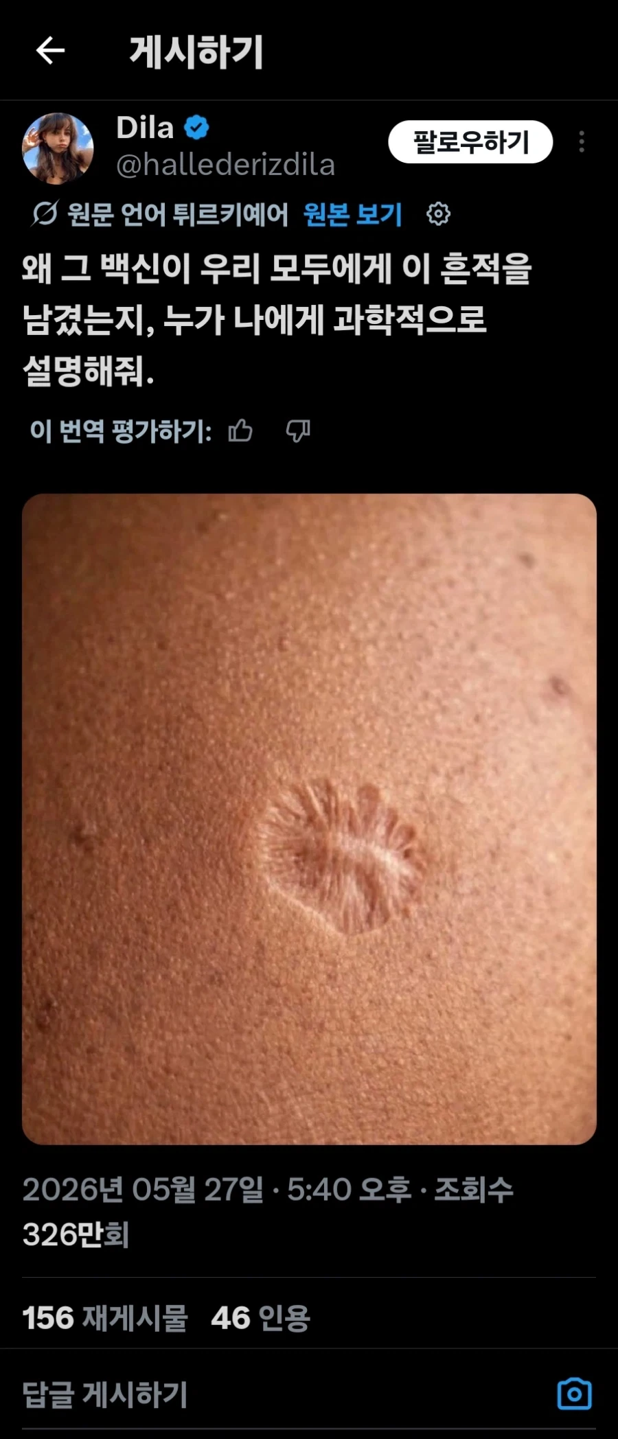의외로 세계 공통으로 퍼져 있는 자국_1.webp