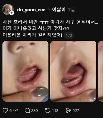 애기 이빨 좀 확인해주라 ㅠㅠ_1.webp