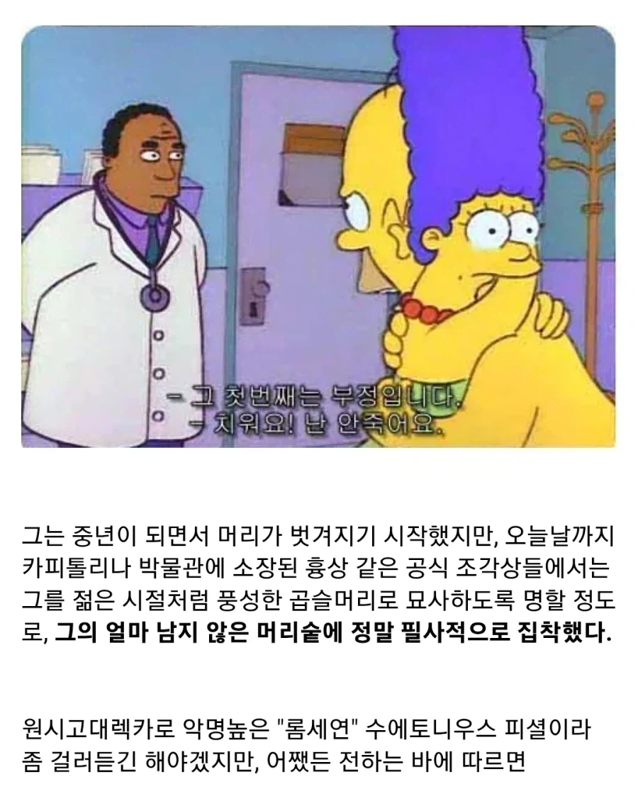 고대 로마 황제의 탈모_2.webp
