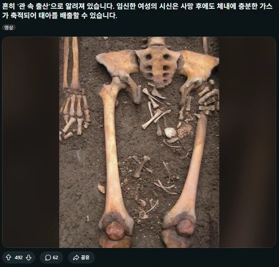 출산에 관한 놀라운 사실._1.webp