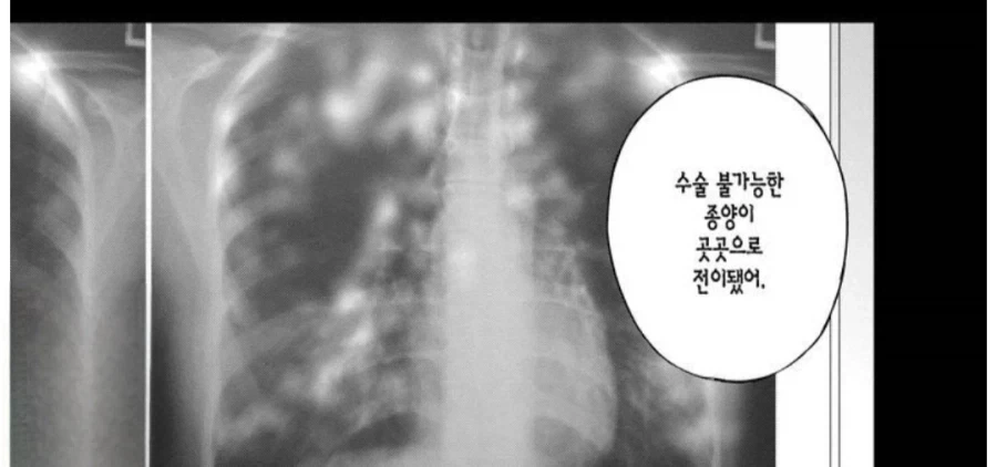 시한부 인생_2.webp