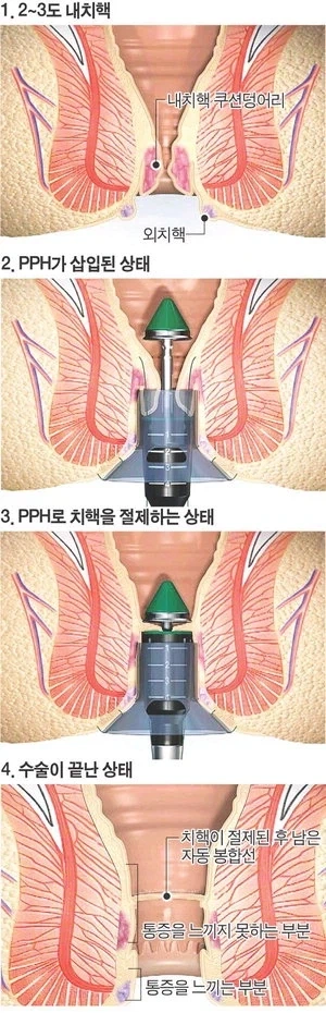 입구 조사 결과 발표_1.webp