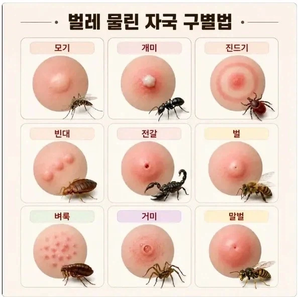 벌레 물린 자국 구별법_1.webp