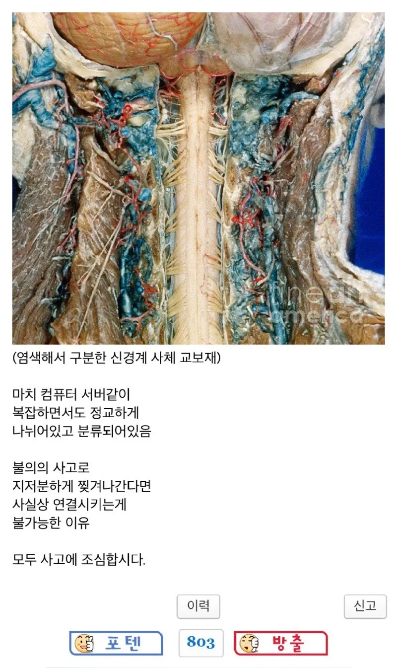 혐) 실제 인간의 척수신경 jpg._2.webp