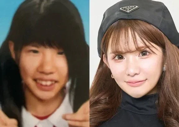 성형을 25번 했다는 여성 ㄷㄷ_4.webp