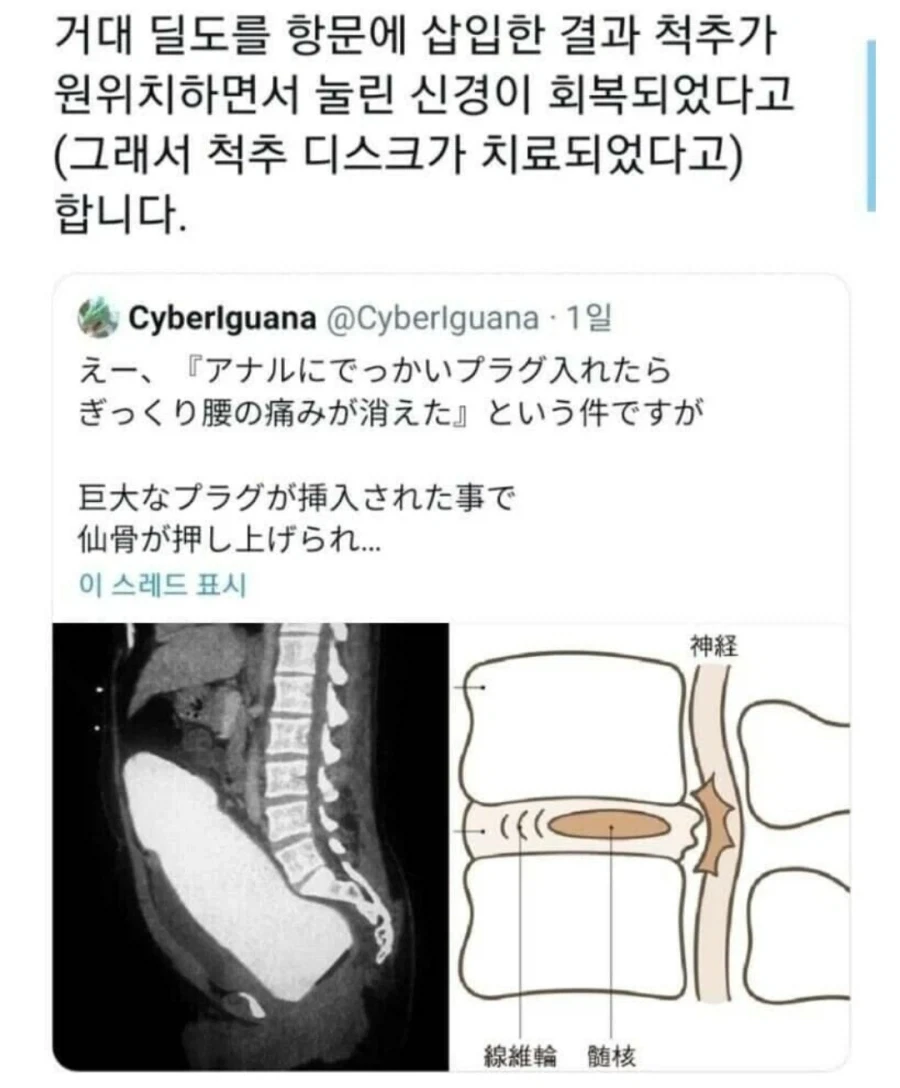 서양인들이 절대 이해할수 없는 한국음식 이미지 9