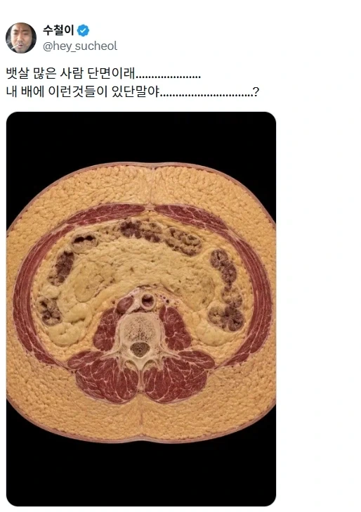 귀접 도와주세요 ㅜㅜ 20대후반 남성... 이미지 10