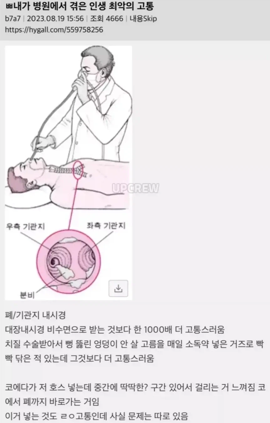이것의 이름이 무엇인지 궁금합니다 이미지 2