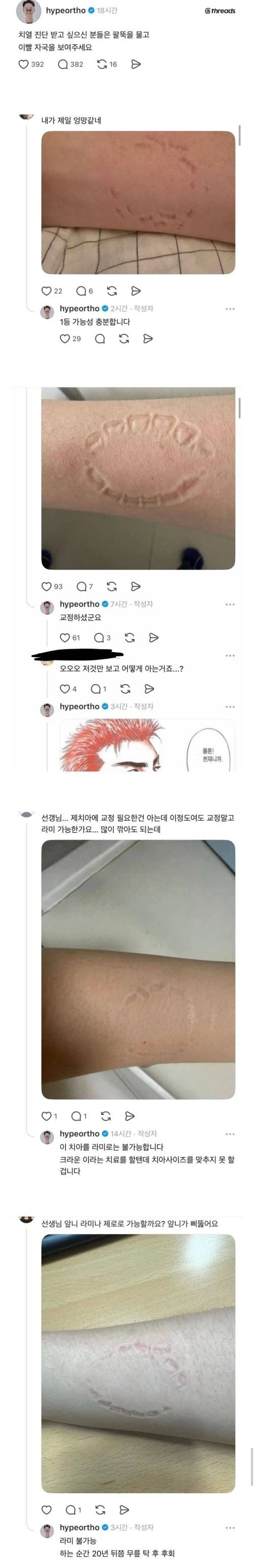 비대면으로 치열진단받기_1.webp
