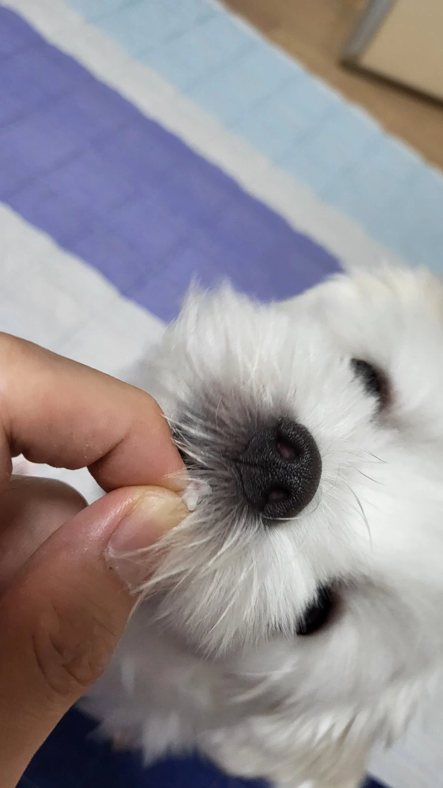 이게 환자분 이빨입니다_3.webp