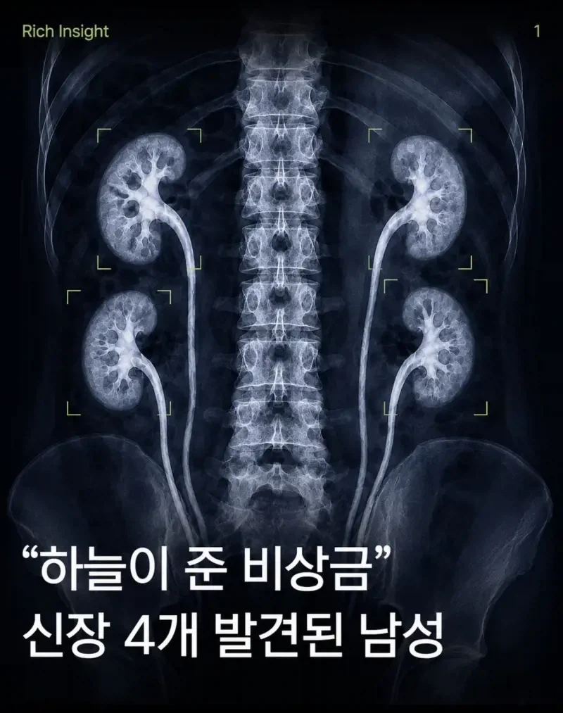 파이어 제이데커는 대충 이렇게 합체합니다.jpg 대표 이미지