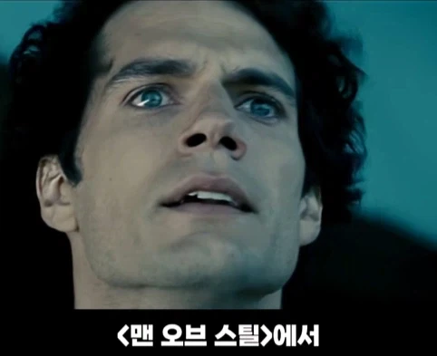 실수로 응급실 가는 사람의 예시.jpg 이미지 3