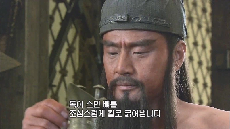 "이 수술을 할려면 환자를 결박하고 얼굴을 가려야합니다" 이미지 15