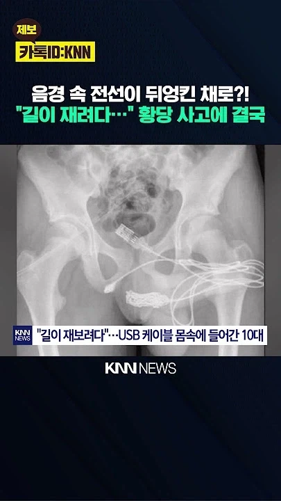 철학과는 입털다 대가리 깨진다는건 안배움? 대표 이미지