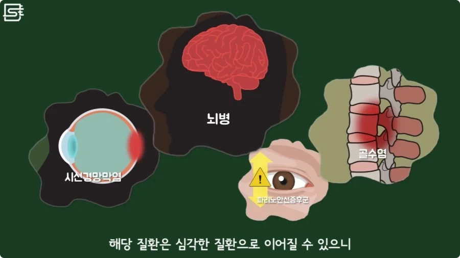 길고양이를 만지면 안되는 이유.jpg_29.webp