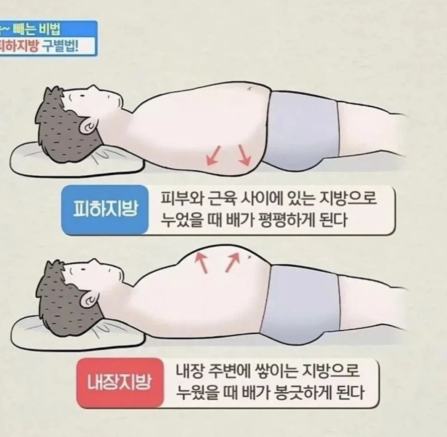 애플 생각이상으로 쓰레기구나 대표 이미지