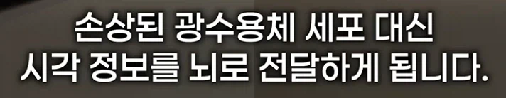 눈에 칩 넣어서 시력 회복해주는 기술_3.webp