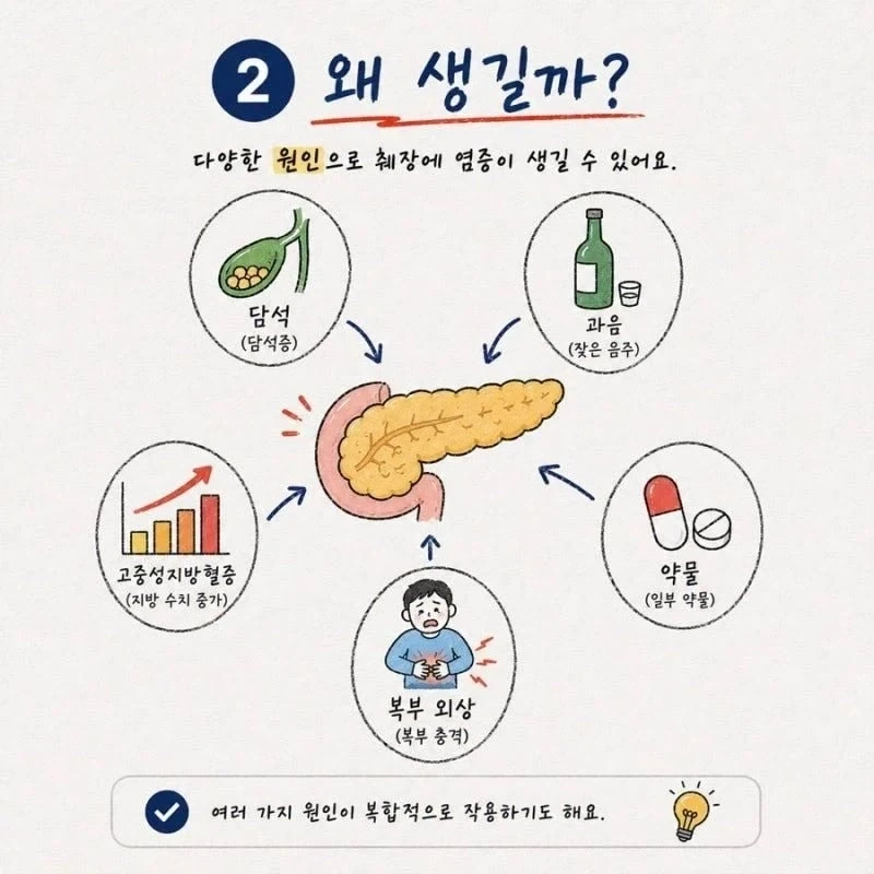 췌장염 초기 증상.jpg_2.webp