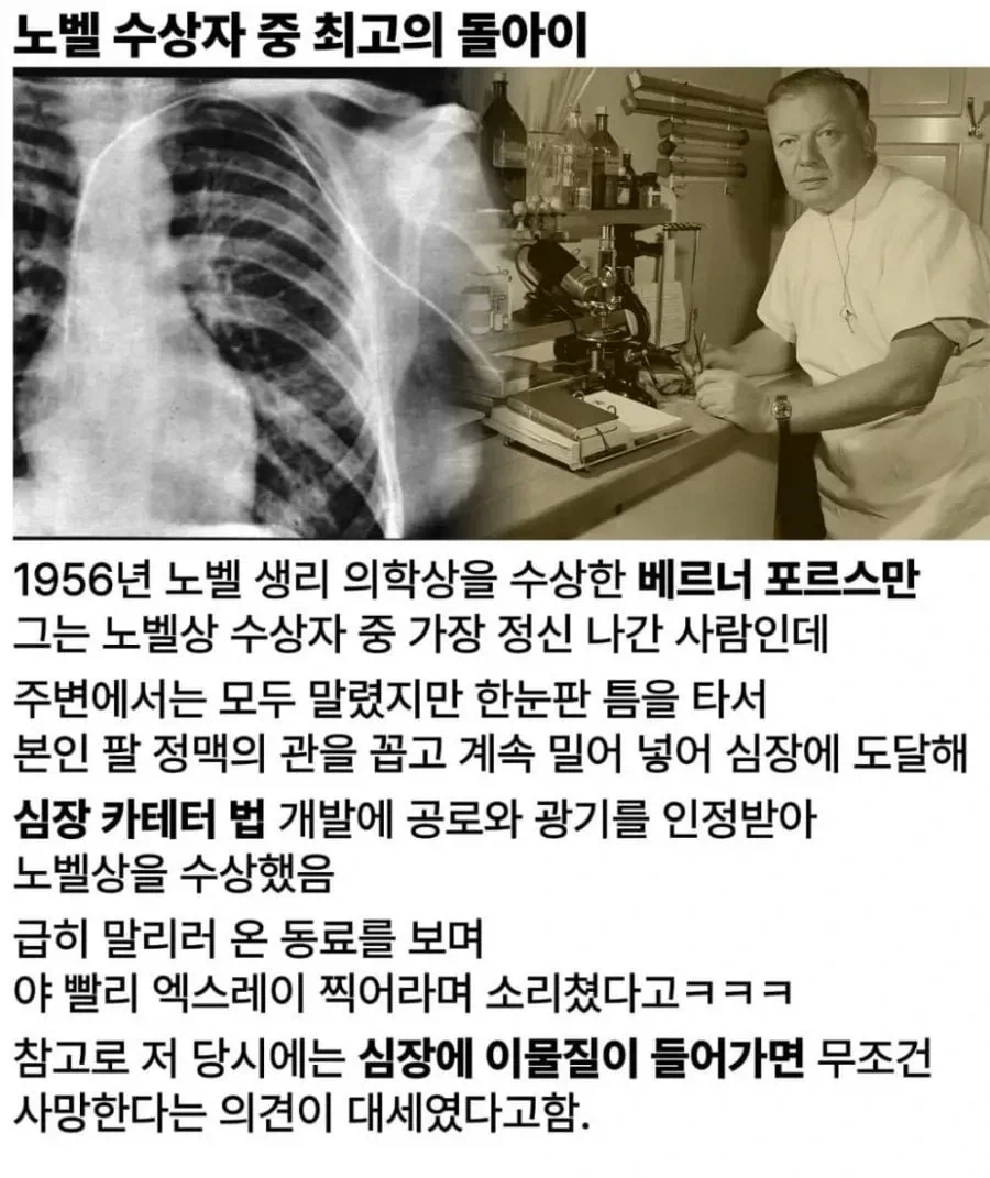 알바뛰는 장이족 대표 이미지
