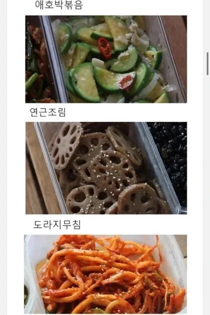 머리선이 보이지만 탈모걱정 없는 사람들 대표 이미지