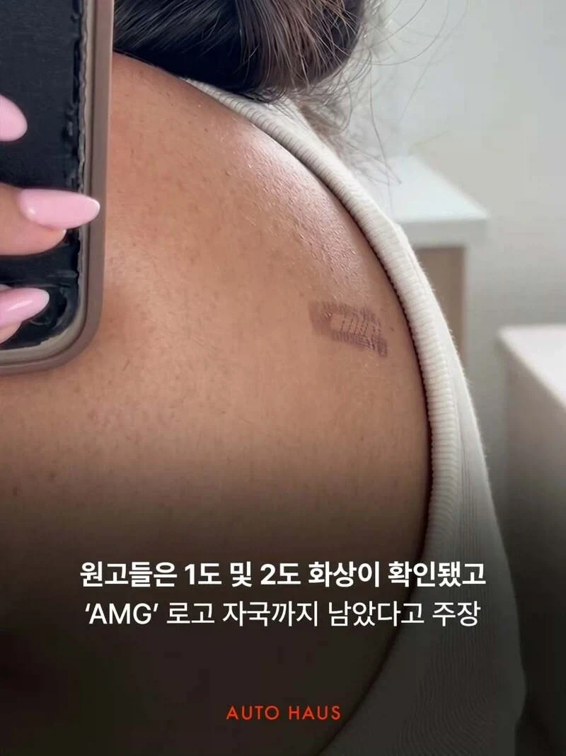 70억 소송 걸린 벤츠_4.webp