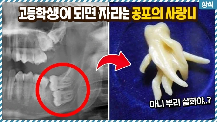 돈 없어 계산 못하는 손님 대신 계산해줘서 사장님이 화냄.... 이미지 4