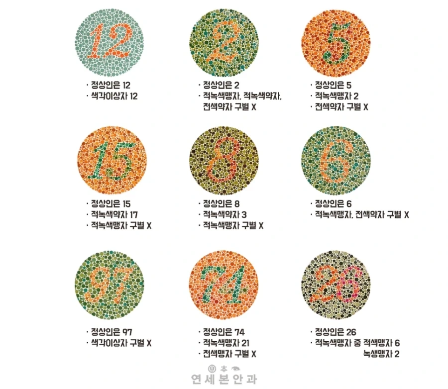 탈모에 대한 스트레스와 집착.. 그리고 절실함을 느끼게 해주는 덧글 대표 이미지