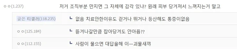 혐) 티눈갤 전설 도래창 사마귀_6.webp