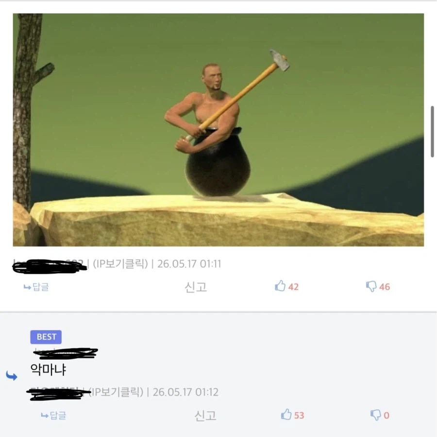 의족을 살 형편이 되지 않았던 가족들.jpg_2.webp