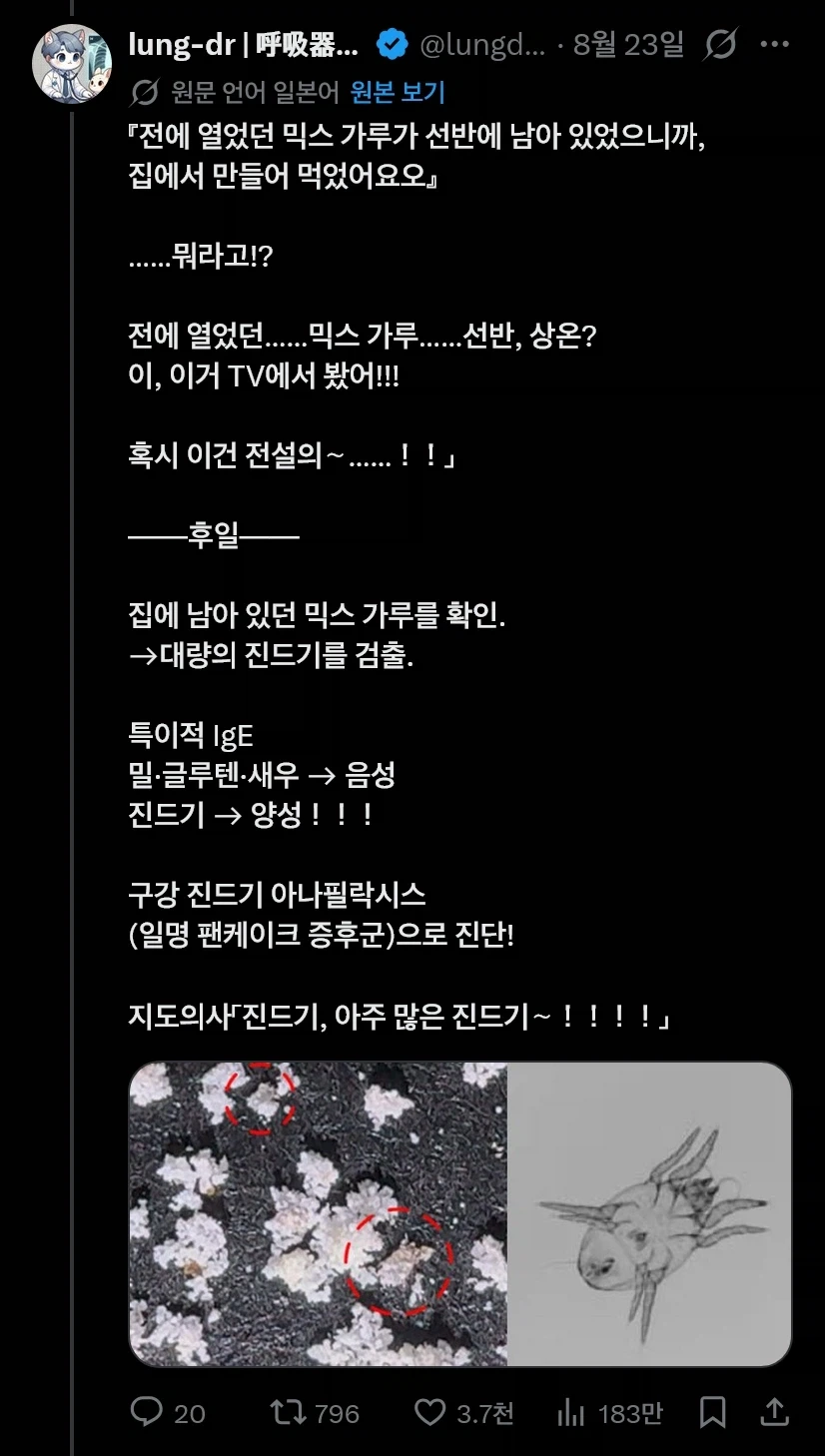 밀가루 알러지는 사실 밀가루 알러지가 아닐수도 있다_2.webp