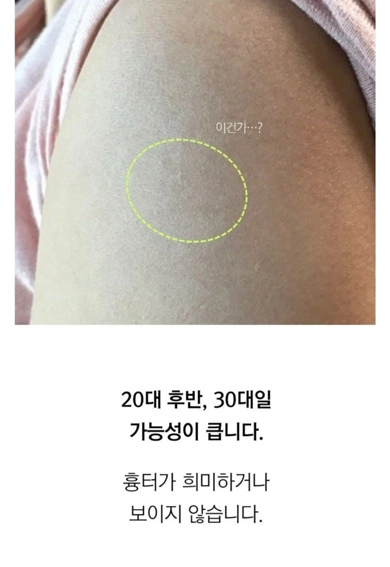불주사 자국으로 보는 세대 판별법.jpg_2.webp