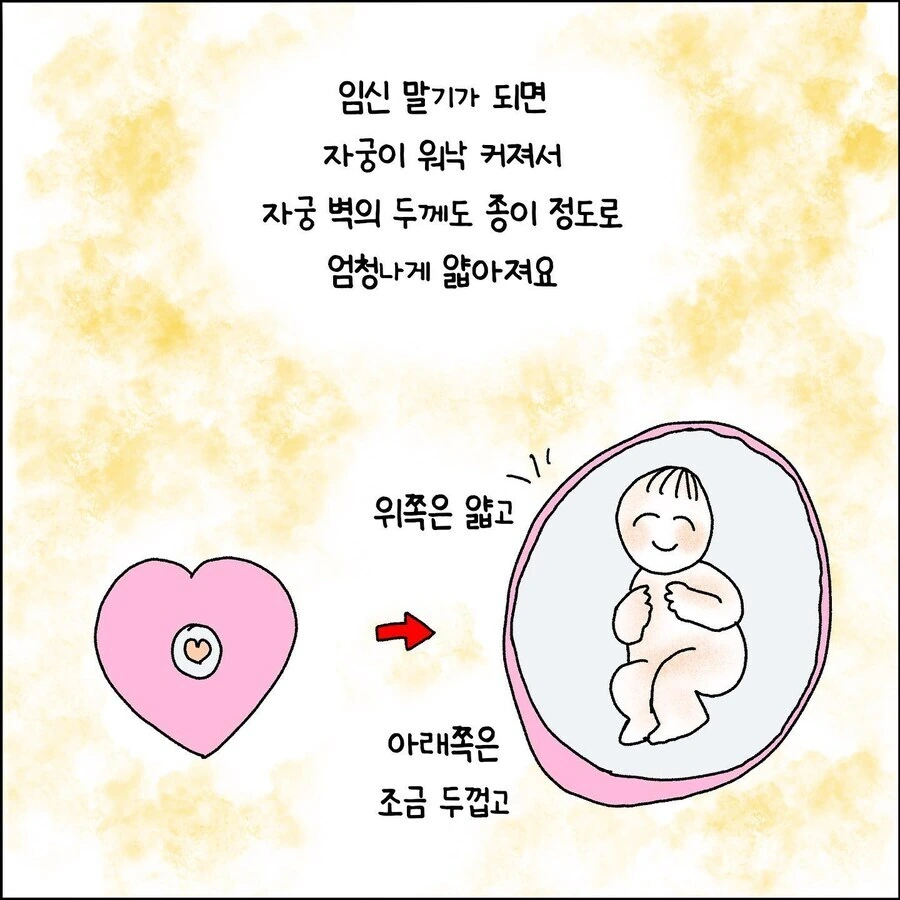 산부인과에서 출산 중 자궁파열 되는 만화.jpg - 이미지 2