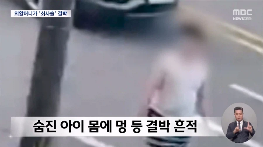 외할머니가 쇠사슬로 11살 아이 침대에 묶어 - 이미지 4