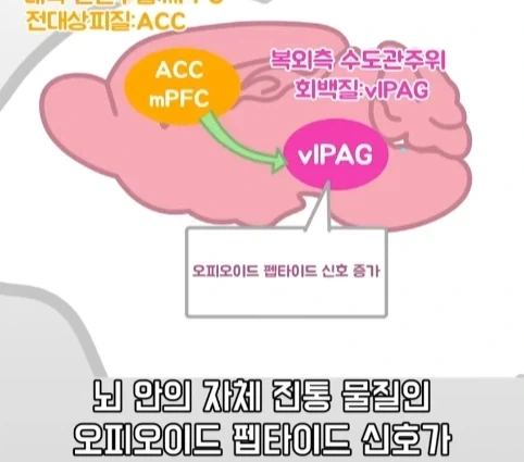 플라시보 효과는 단순 기분탓이 아니라는 연구.jpg - 이미지 30