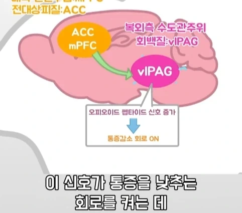 플라시보 효과는 단순 기분탓이 아니라는 연구.jpg - 이미지 32