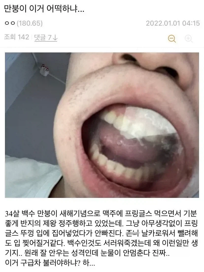 프링글스 뚜껑으로 장난치다 ㅈ된 아저씨.jpg