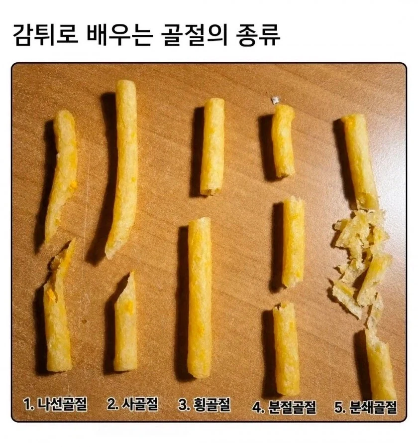 감튀로 배우는 골절의 종류