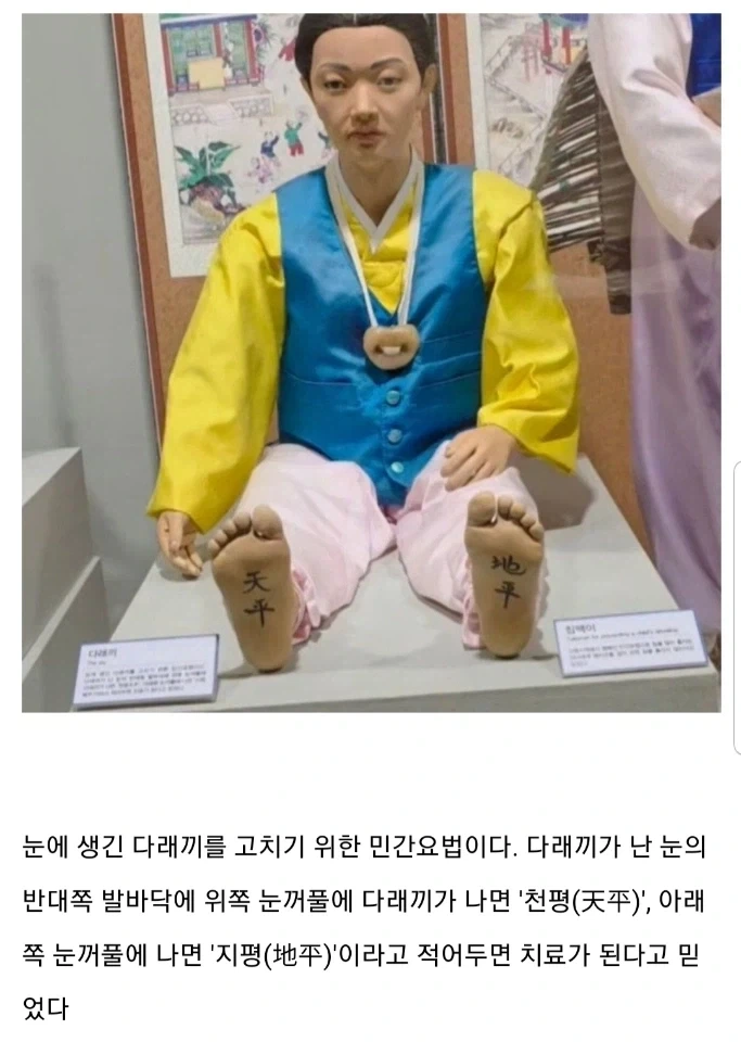 다래끼를 고치는 옛날 민간요법