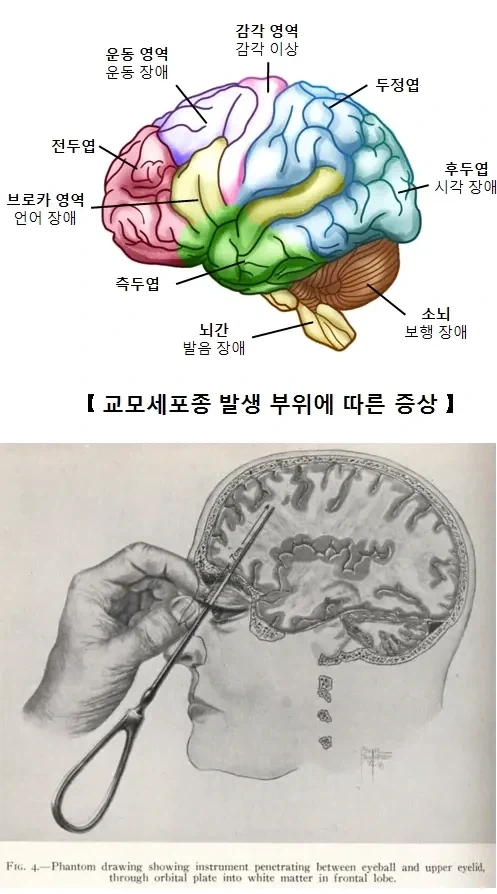인류가 알고 있는 유일한 조현병 완치법 - 이미지 2