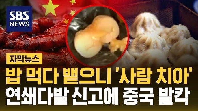 중국 만두에서 이빨이 나온 사건