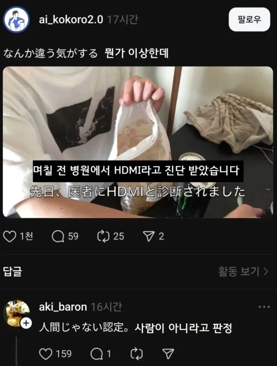 며칠 전 병원에서 HDMI라고 진단 받았습니다.
