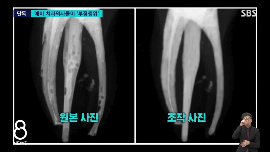 ＇애들이 잘해보려다 그럴수도 있죠＇ 레전드 - 이미지 2