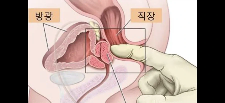 직장내 괴롭힘 - 이미지 2