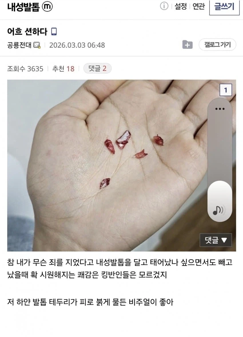 (혐) 인간의 정신력을 볼 수 있는 갤러리