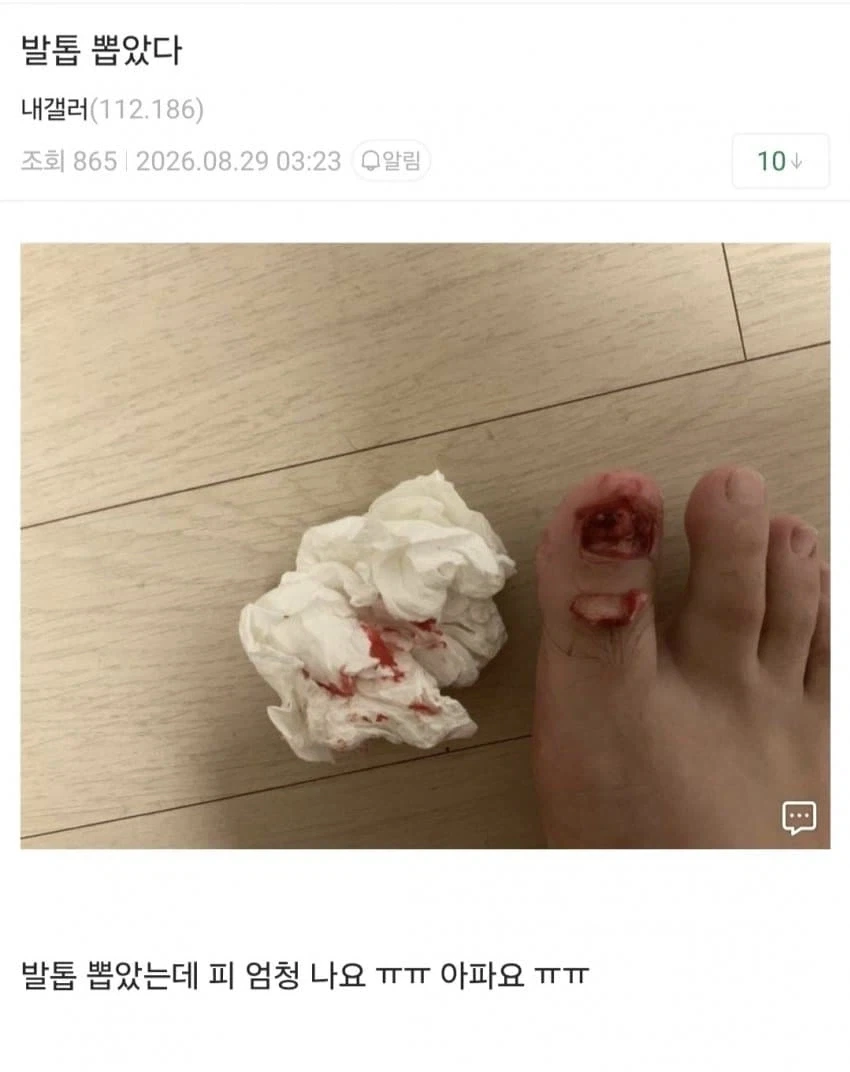 (혐) 인간의 정신력을 볼 수 있는 갤러리 - 이미지 3