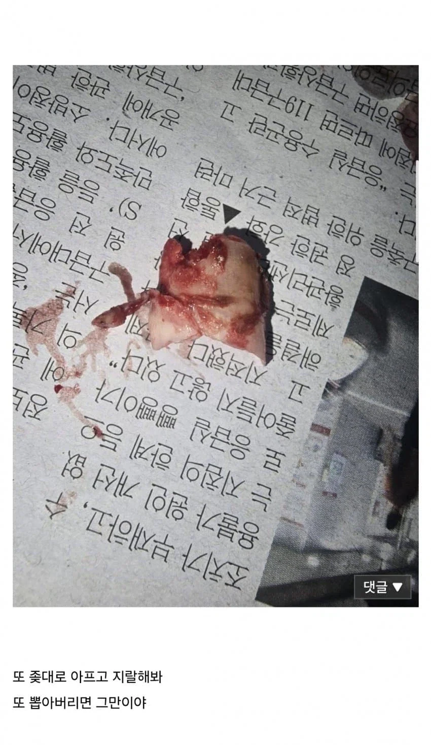 (혐) 인간의 정신력을 볼 수 있는 갤러리 - 이미지 5