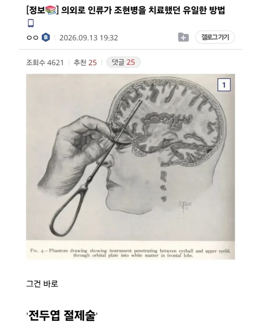 의외로 인류가 조현병을 치료했던 유일한 방법.jpg
