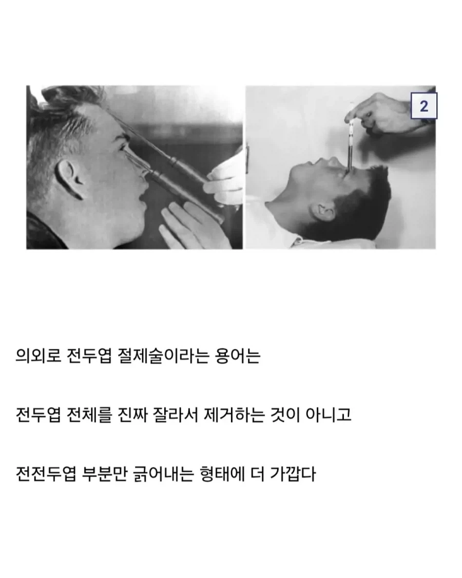 의외로 인류가 조현병을 치료했던 유일한 방법.jpg - 이미지 3