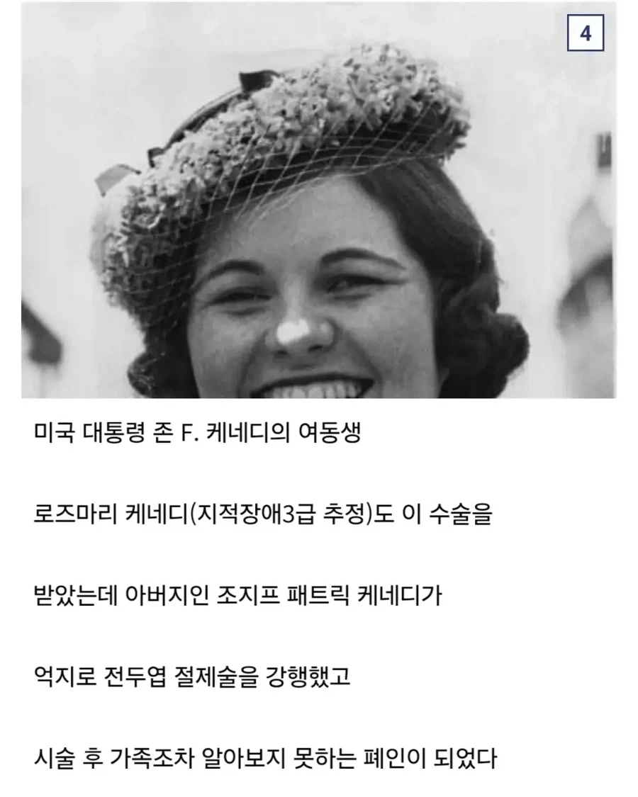 의외로 인류가 조현병을 치료했던 유일한 방법.jpg - 이미지 7